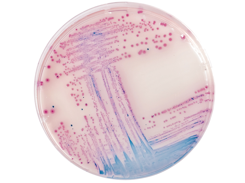 科瑪嘉 Salmonella    　 / 科瑪嘉 沙門氏桿菌